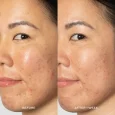 OH394101_PPage_Refresh_Infographics_GLOW2OH_BEFOREAFTER_1500x1500_72DPI_800x