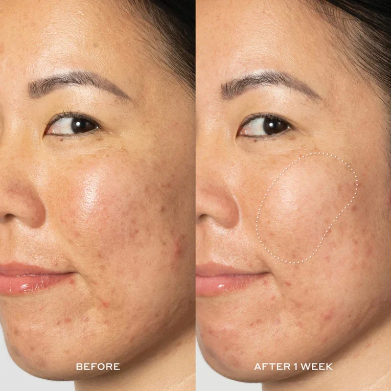OH394101_PPage_Refresh_Infographics_GLOW2OH_BEFOREAFTER_1500x1500_72DPI_800x